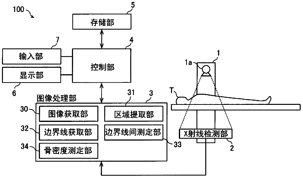 X-ray imaging device