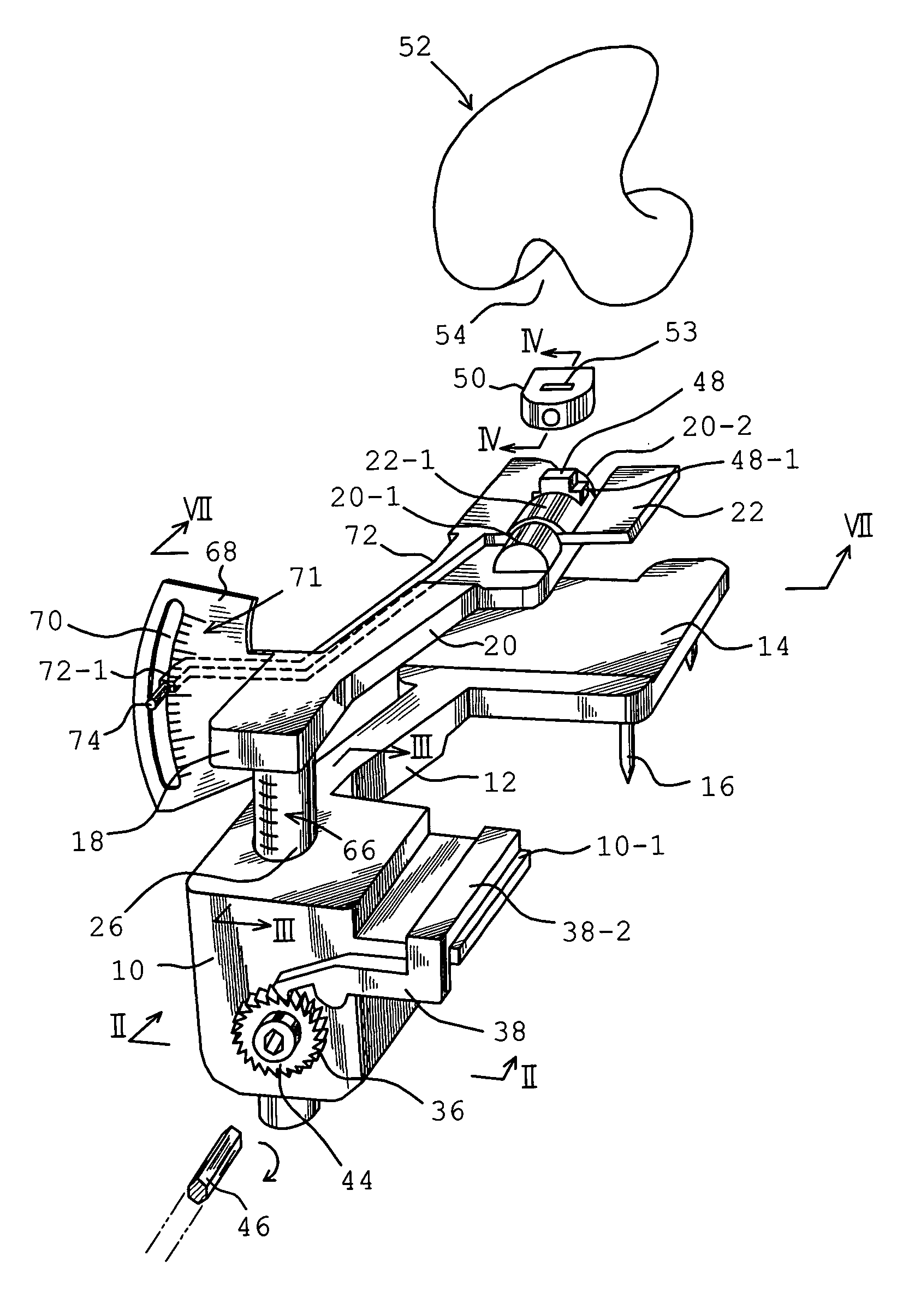 Measuring apparatus for total knee replacement operation