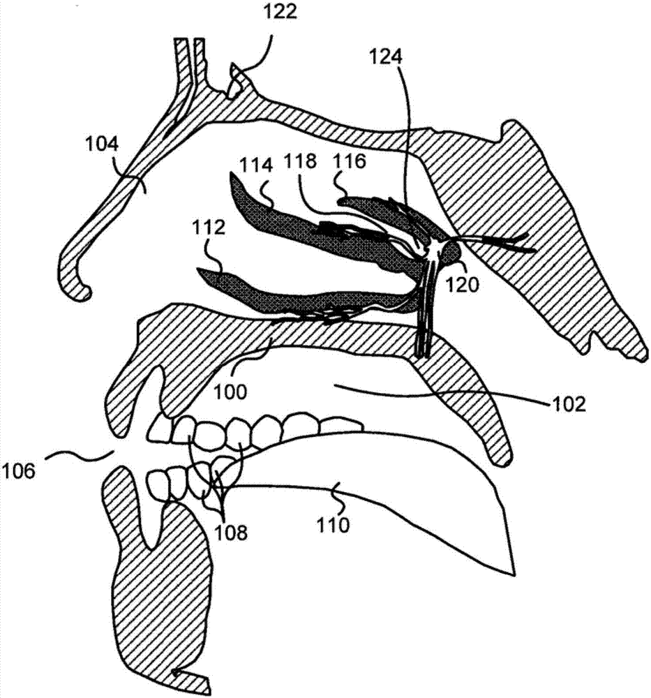 Systems and devices that facilitate intranasal therapy for patients