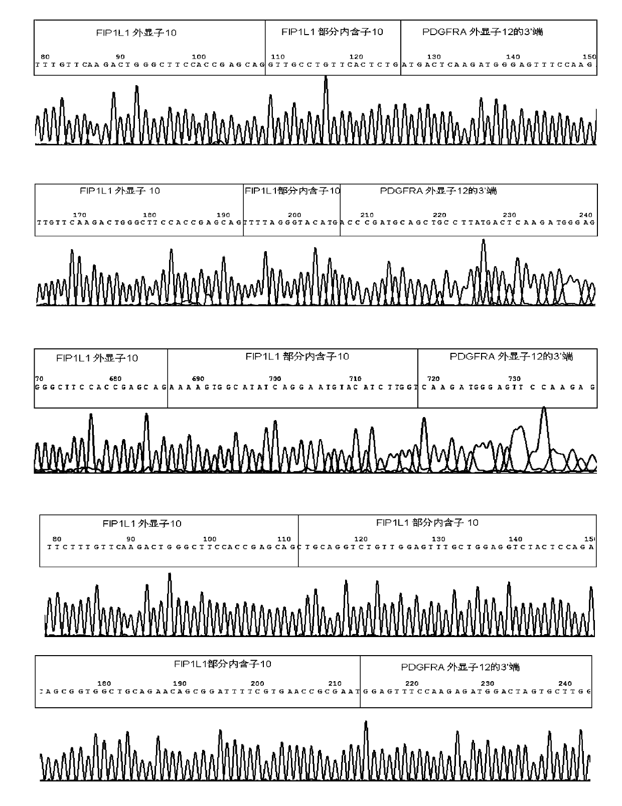 Reagent kid for quantitatively testing mRNA (messenger ribonucleic acid) level of FIP1L1-PDGFRA (feline infectious peritonitis 1 like 1-platelet-derived growth factor receptor alpha) fusion genes