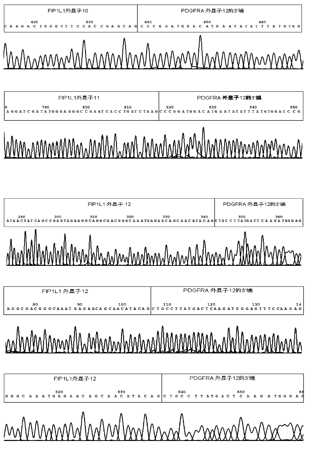 Reagent kid for quantitatively testing mRNA (messenger ribonucleic acid) level of FIP1L1-PDGFRA (feline infectious peritonitis 1 like 1-platelet-derived growth factor receptor alpha) fusion genes