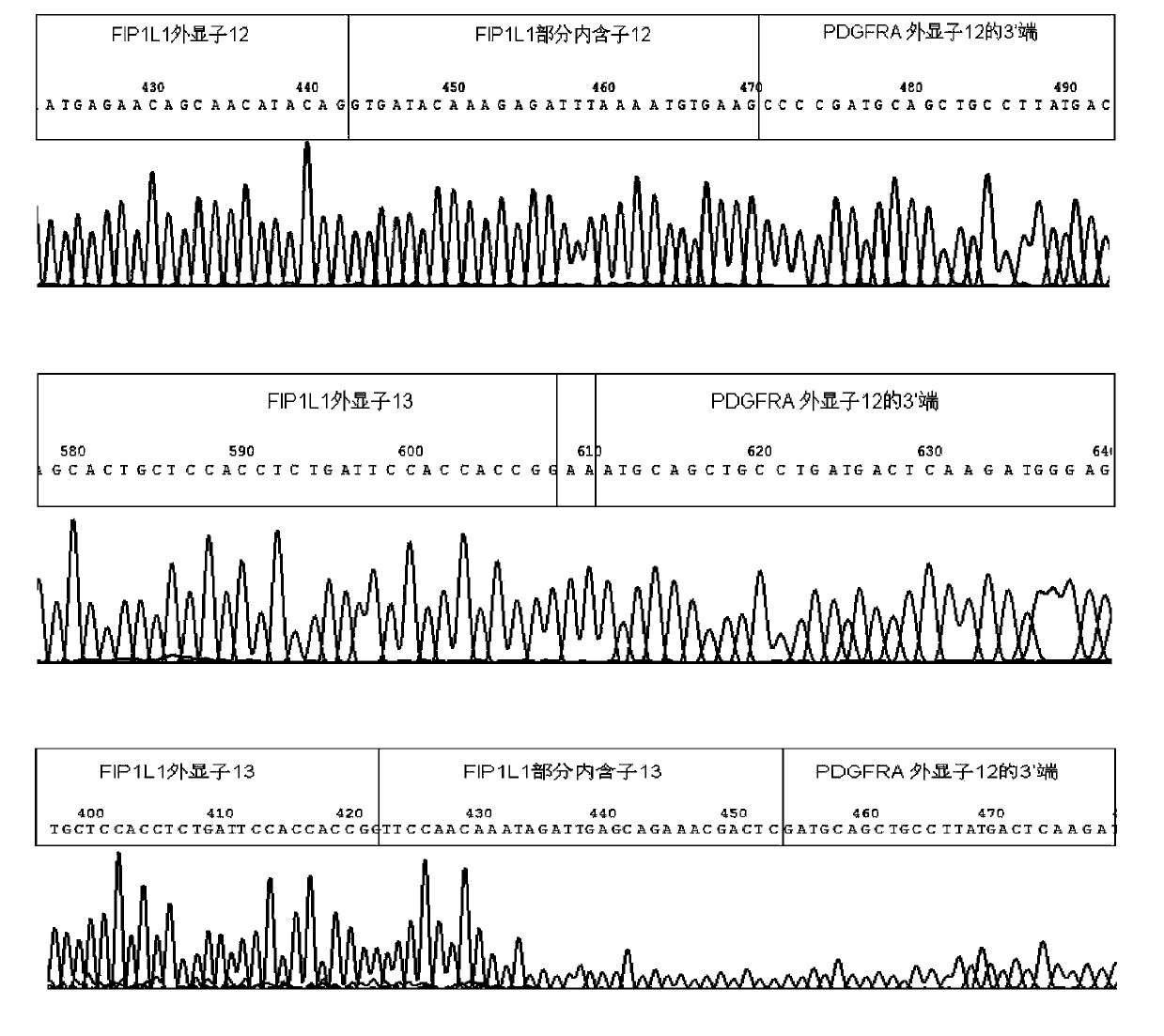 Reagent kid for quantitatively testing mRNA (messenger ribonucleic acid) level of FIP1L1-PDGFRA (feline infectious peritonitis 1 like 1-platelet-derived growth factor receptor alpha) fusion genes