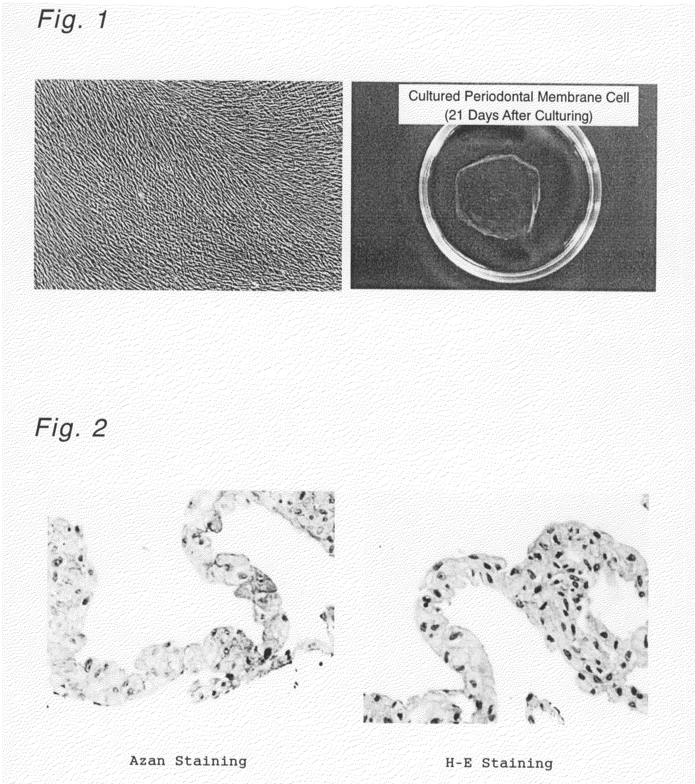 Cultured Periodontal Membrane Cell Sheet, Process for Producing the Same and Method of Use Thereof