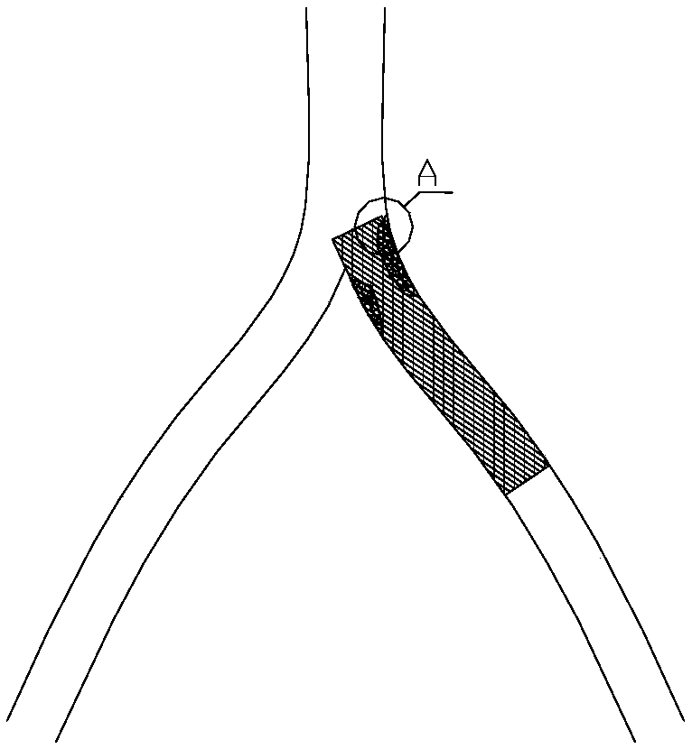 Bifurcation-adjacent part lesion applicable stent