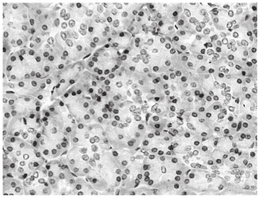 TIPE3 immunohistochemical detection kit as well as use method and application thereof