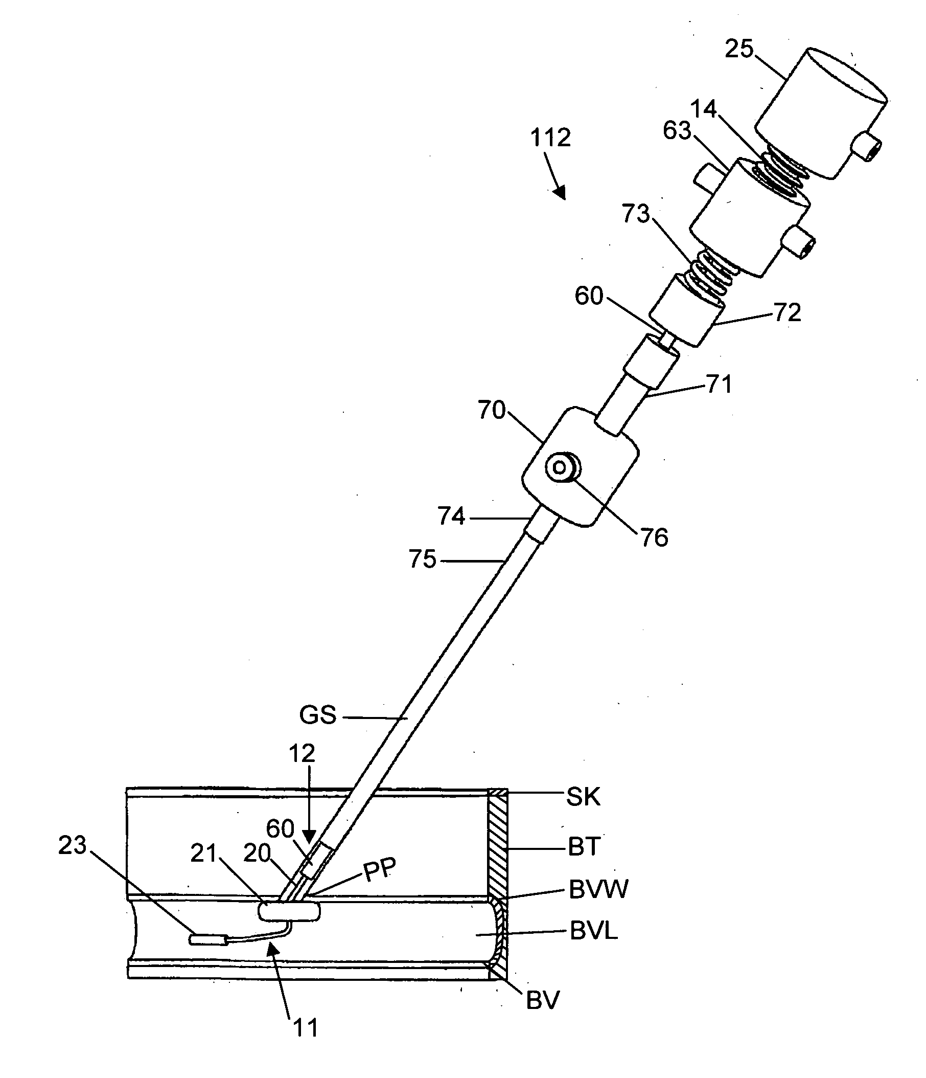 Method and system for sealing percutaneous punctures