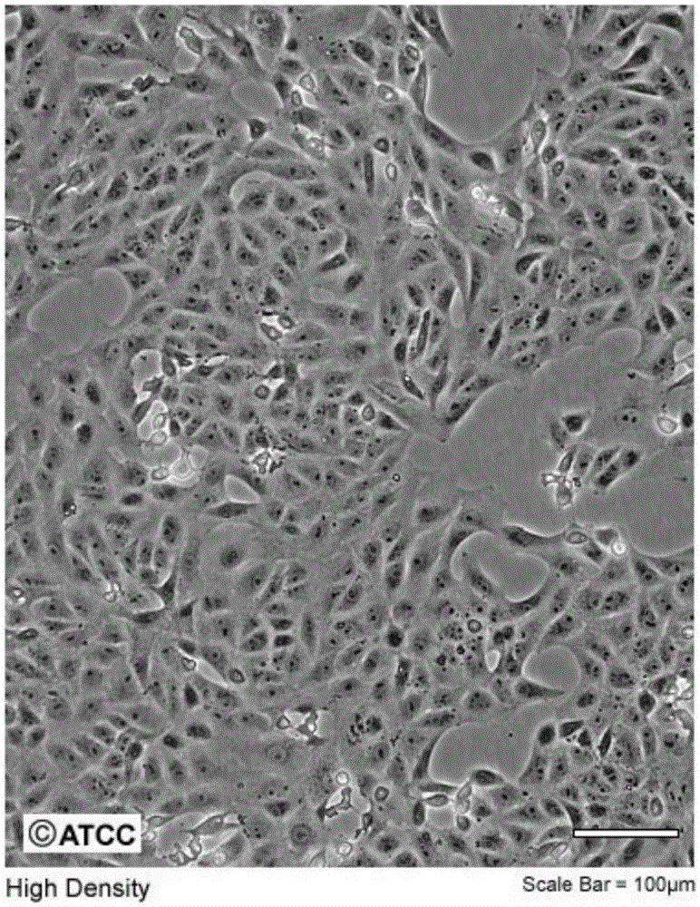 Low-serum protein-free culture medium applicable to Vero cell growth and preparation method thereof