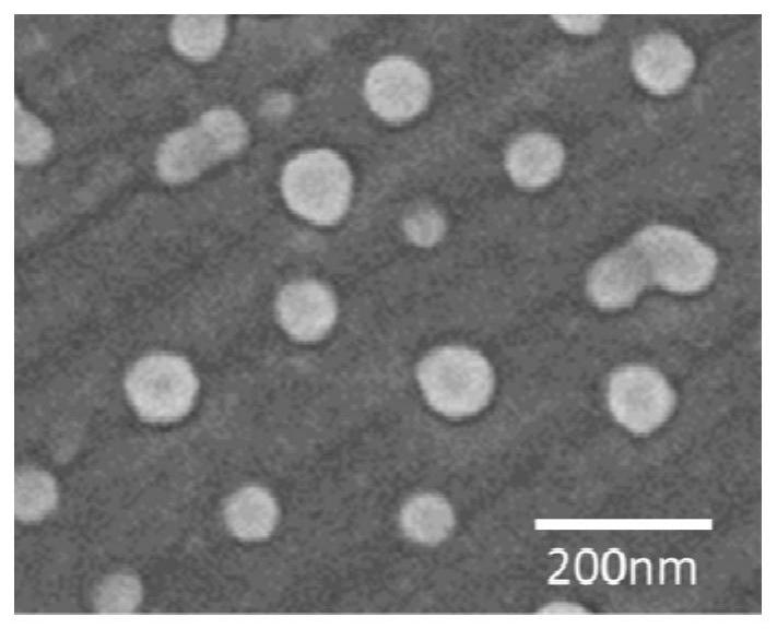 A locally deliverable nano-preparation for inhibiting inflammation of radiofrequency ablation cardiac tissue, its preparation method and application