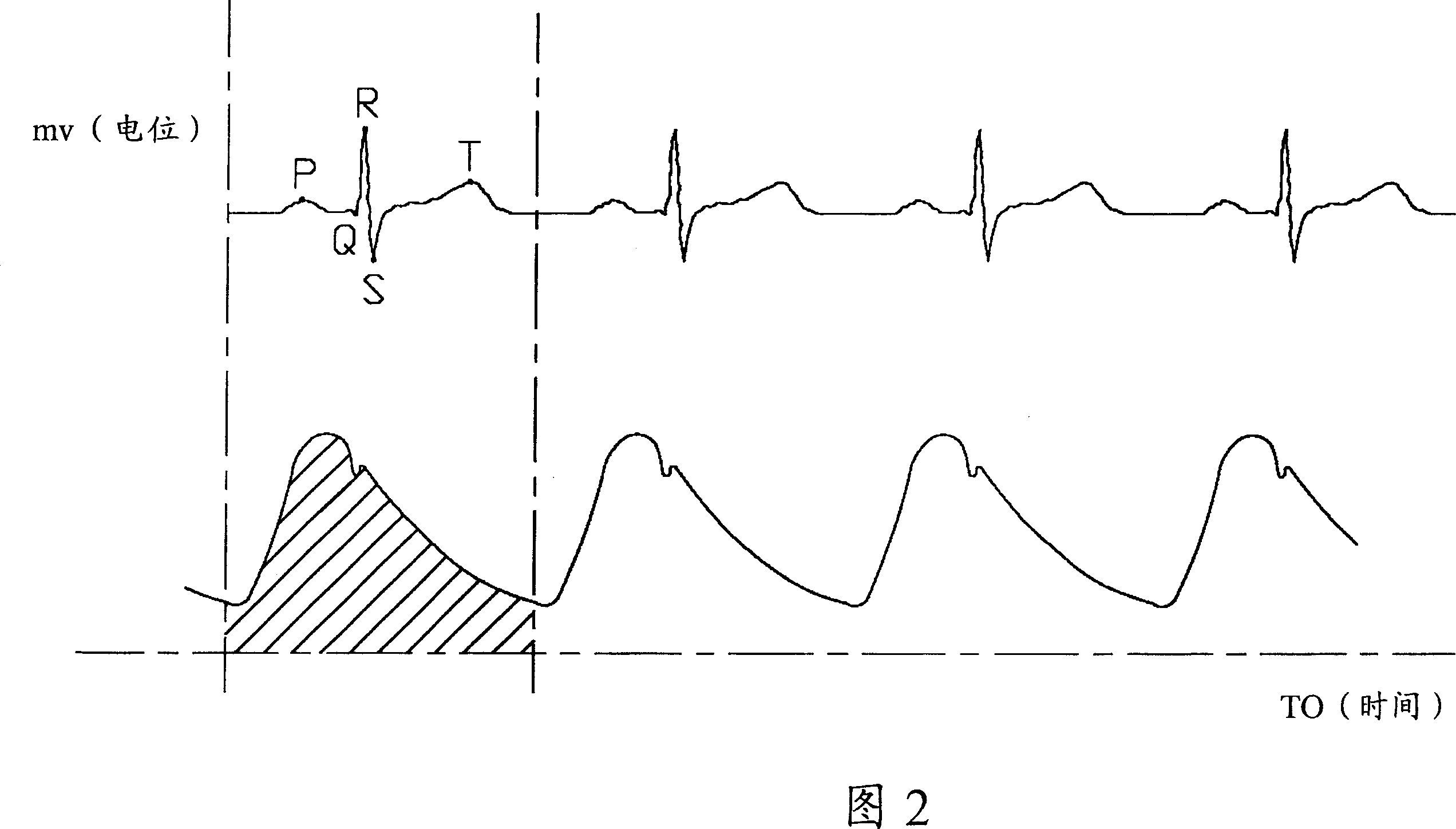 Method and apparatus for measuring blood pressure by using blood oxygen concentration and electrocardiograph