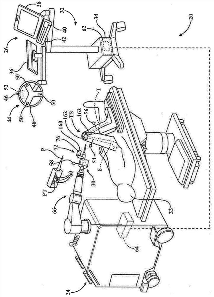 Systems and methods for identifying and tracking physical objects during robotic surgical procedures