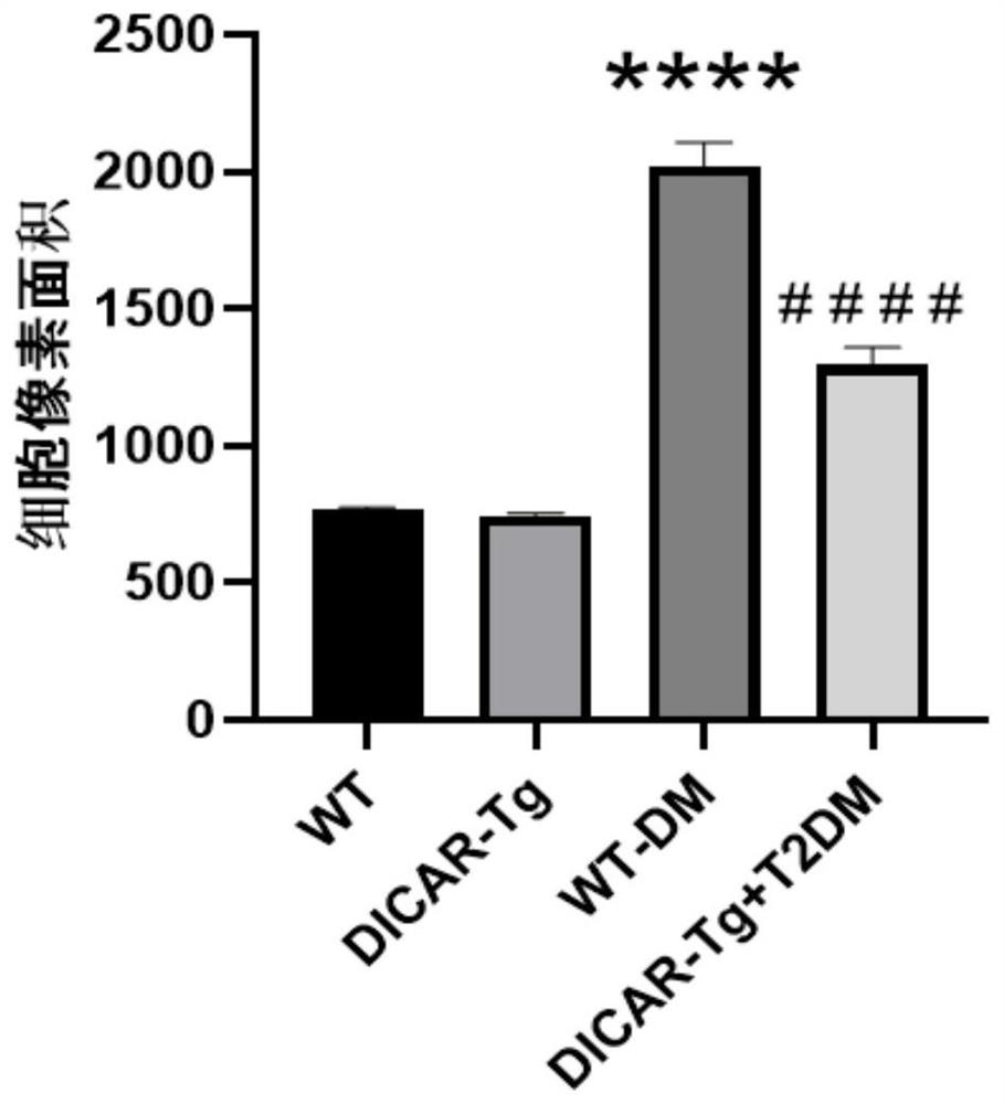 Nucleic acid medicine for diabetic cardiomyopathy and application thereof