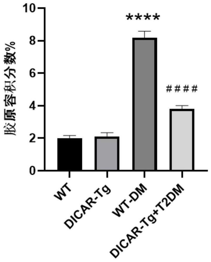 Nucleic acid medicine for diabetic cardiomyopathy and application thereof