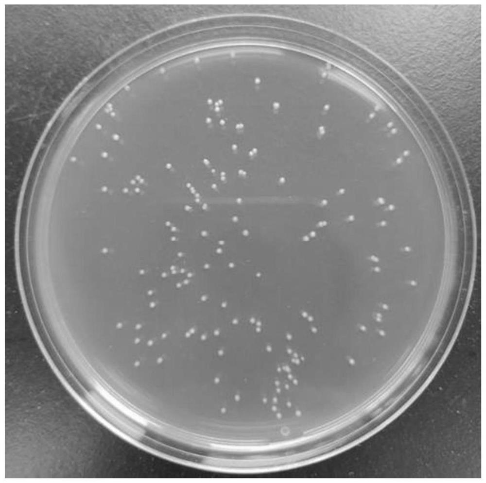 A kind of Lactobacillus helveticus bacterial strain with effect of improving depression and application thereof