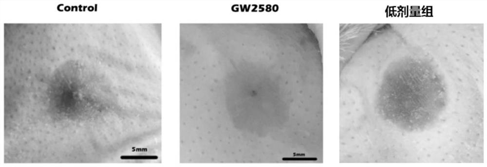 Anti-scar biomaterial, preparation method and use thereof