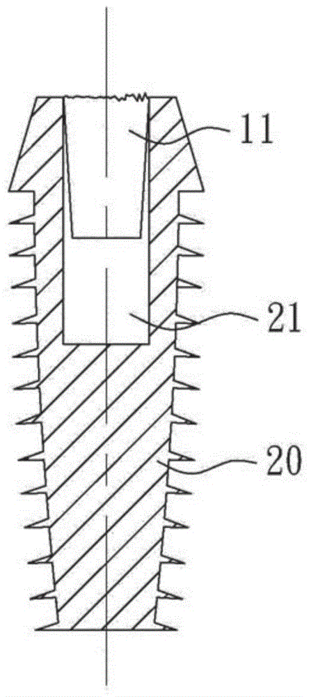 Locking dovetail body with weakened zone