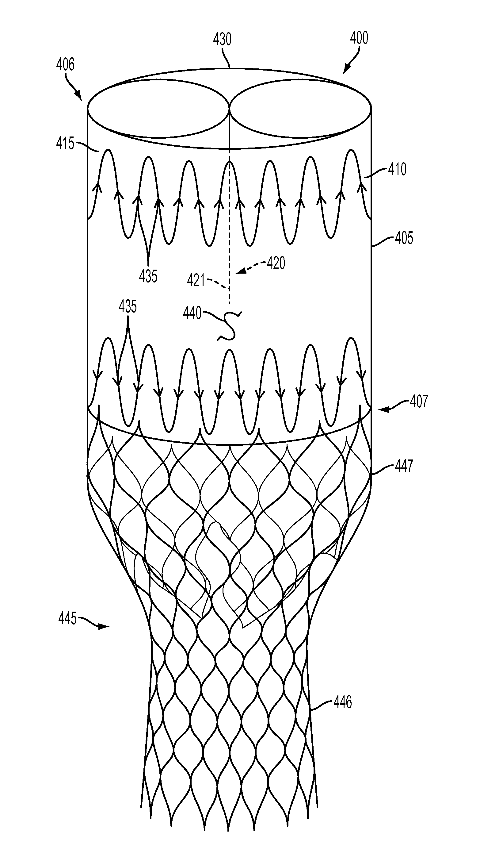 Debranching Visceral Stent Graft and Methods for Use