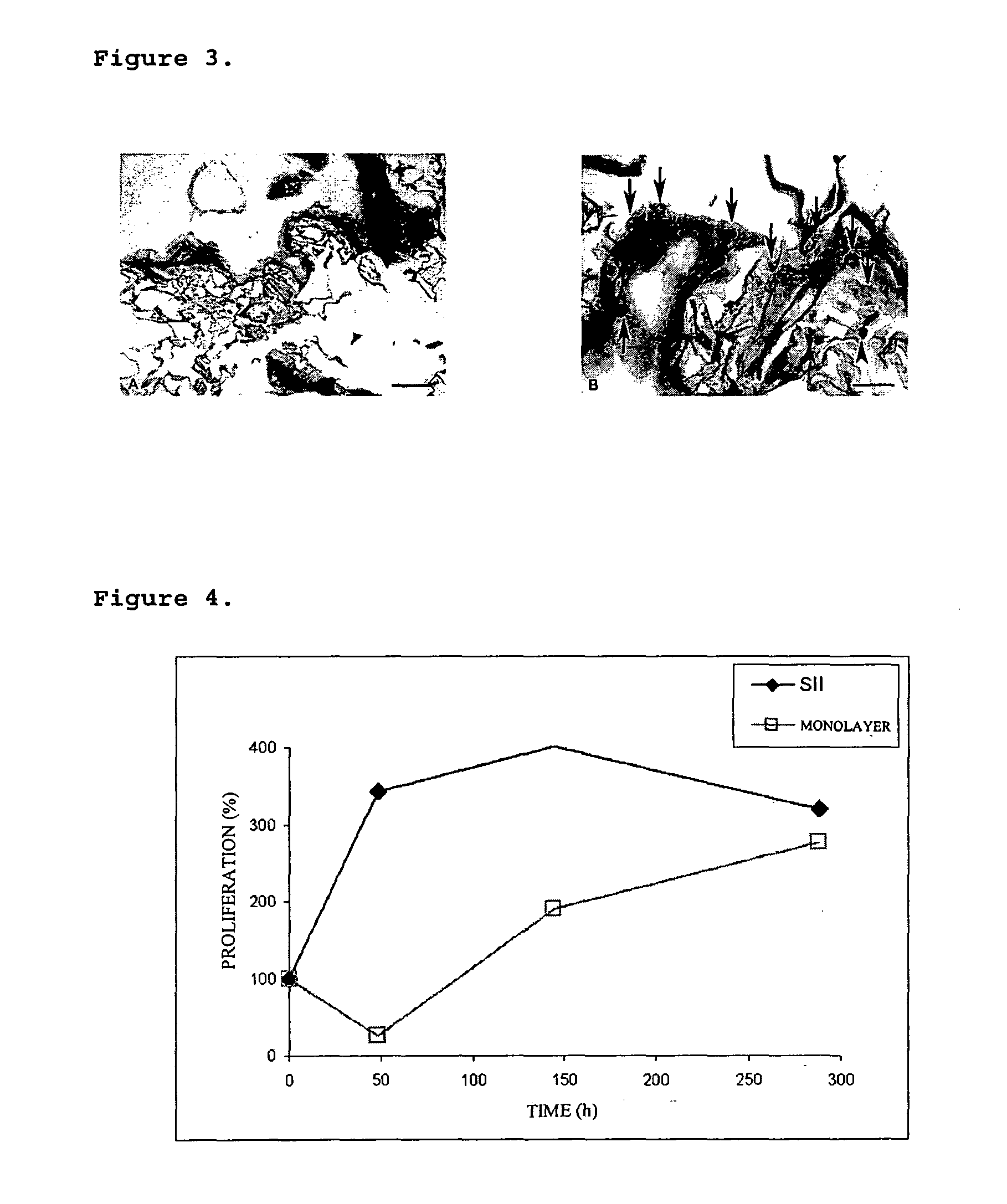 Integrated implant system (IIS) biocompatible, biodegradable and bioactive, comprising a biocompatible sterile porous polymeric matrix and a gel, integrating in situ the tridimensional matrix structure