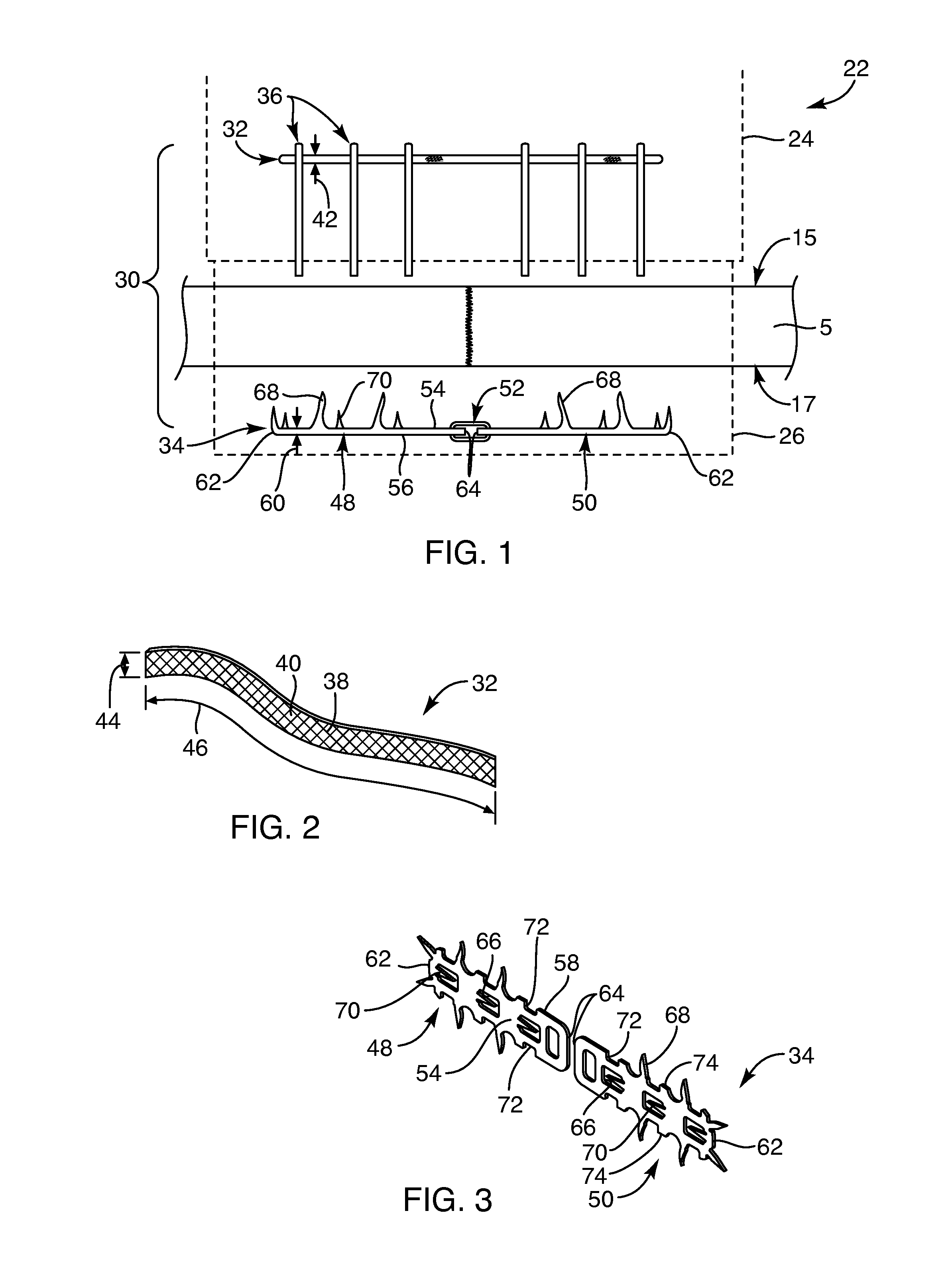 Devices, systems, and methods for repairing soft tissue and attaching soft tissue to bone