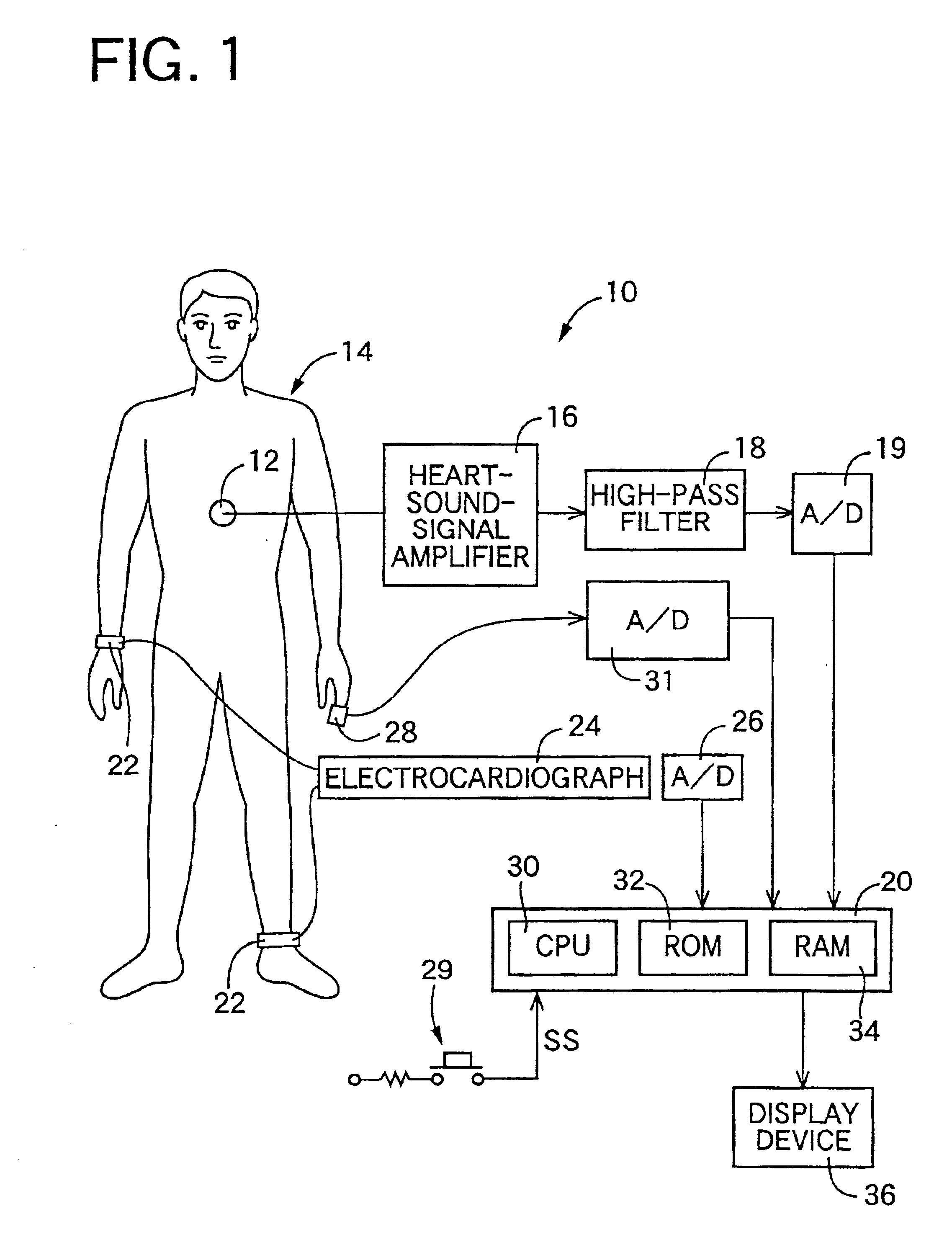 Heart-sound detecting apparatus and pulse-wave-propagation-velocity-relating-information obtaining system using the heart-sound detecting apparatus