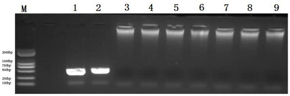 Egg yolk antibody for preventing and treating novel goose astrovirus with cross-species transmission capacity and preparation method thereof