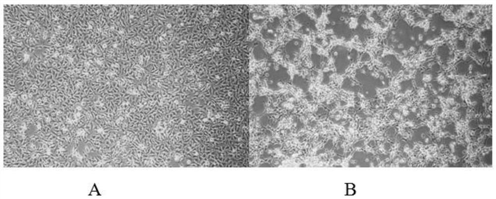Egg yolk antibody for preventing and treating novel goose astrovirus with cross-species transmission capacity and preparation method thereof