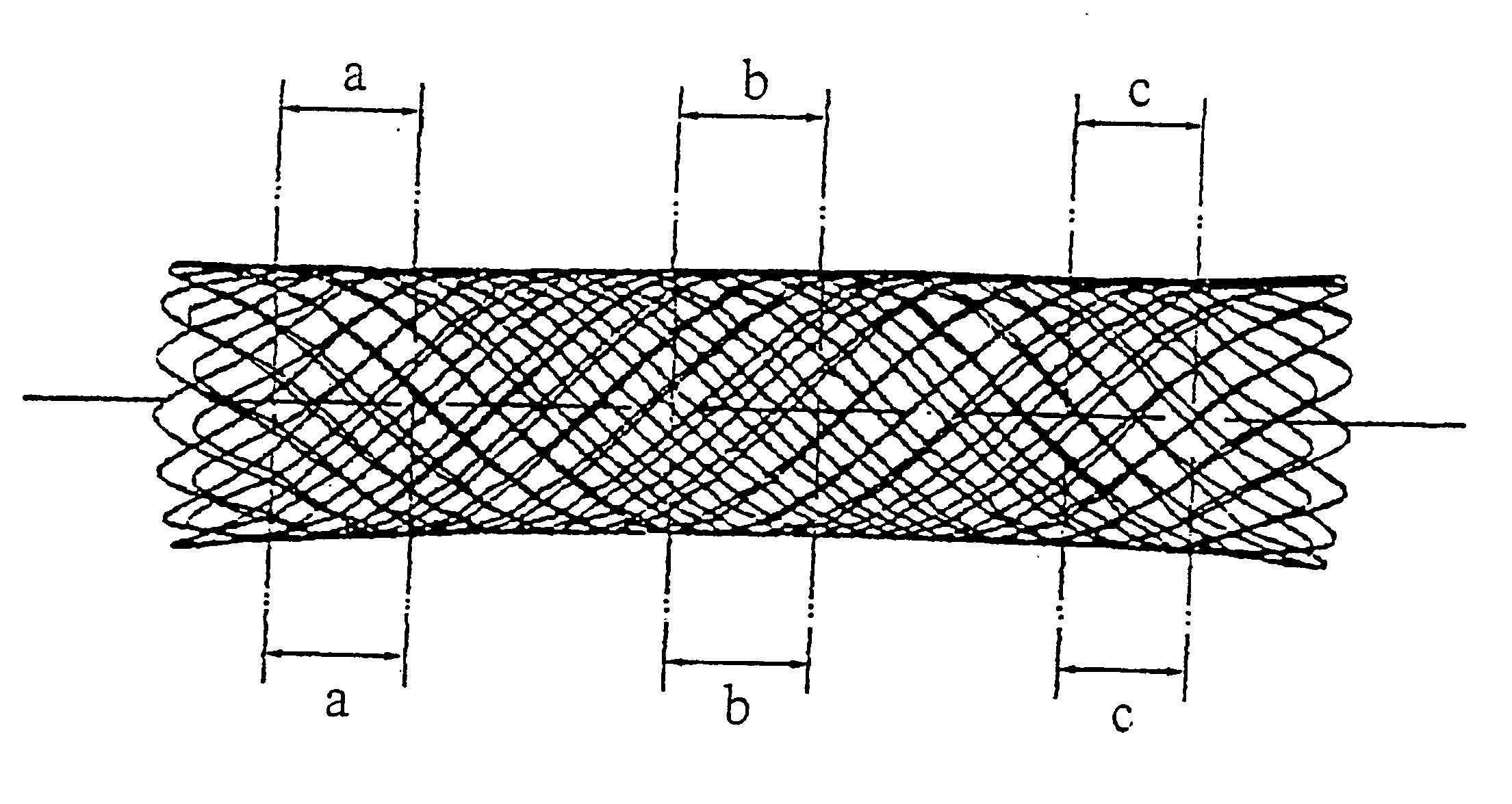 Stent and method for the production thereof (variants)