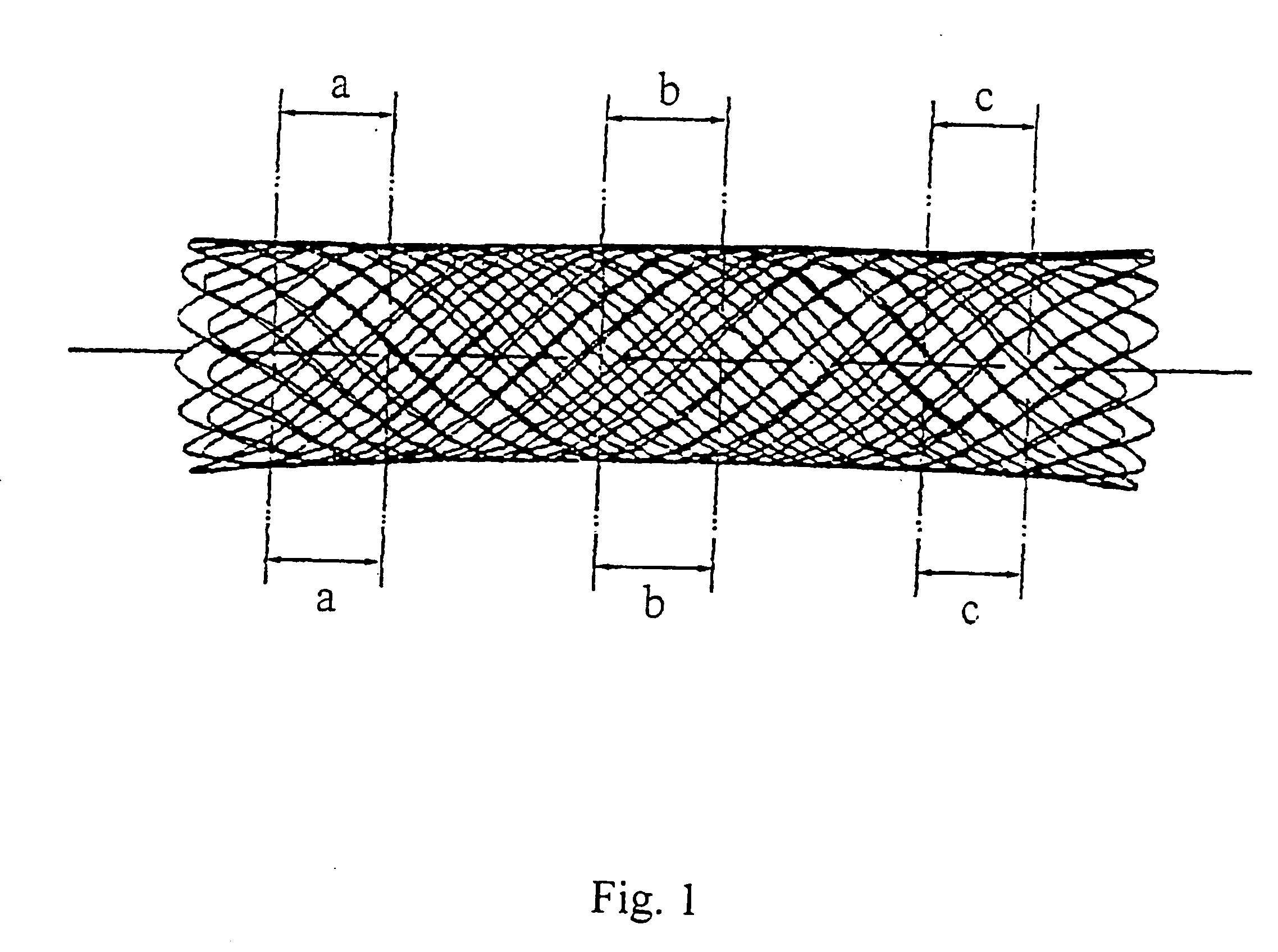 Stent and method for the production thereof (variants)