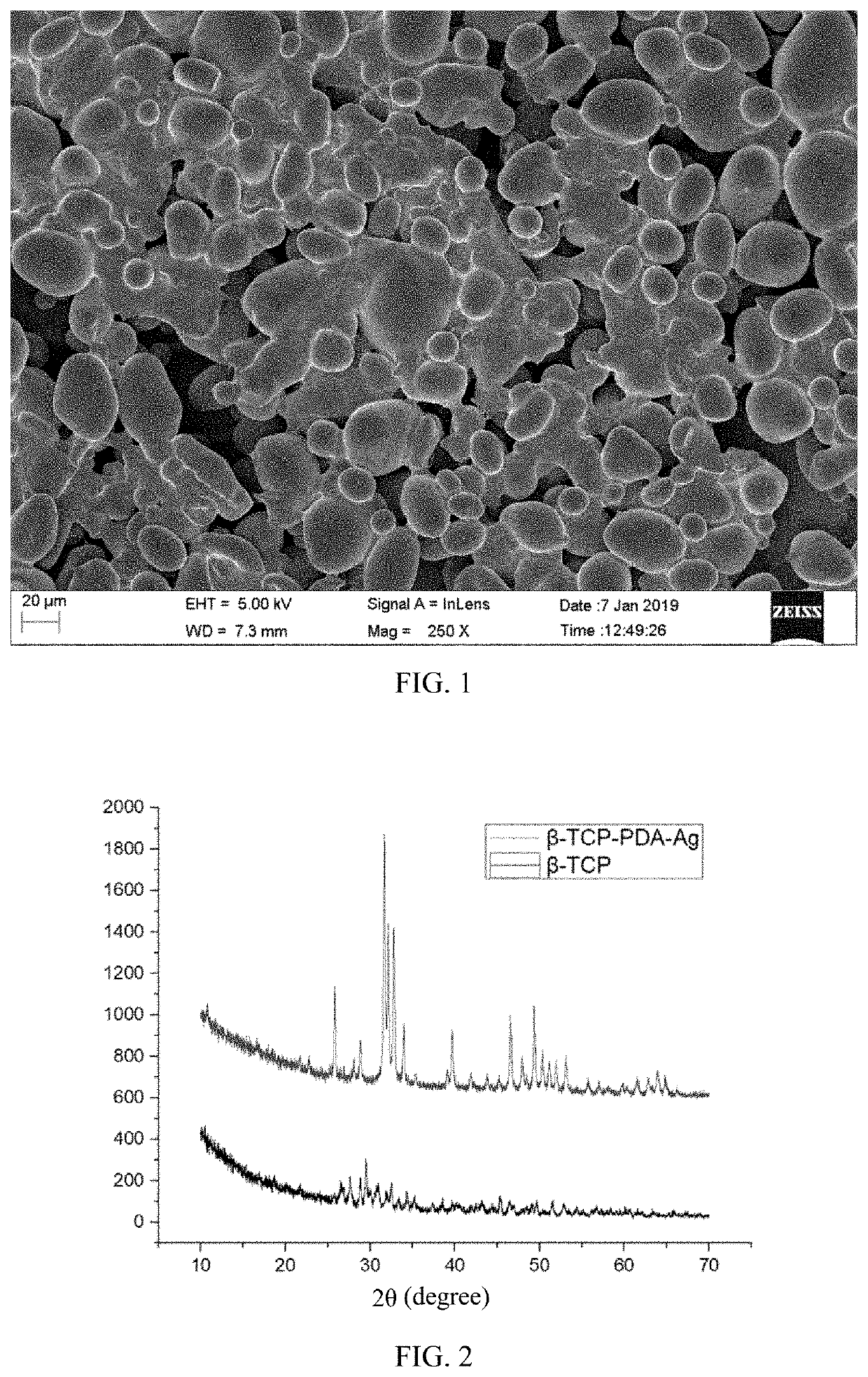 Absorbable bone wax and preparation method thereof