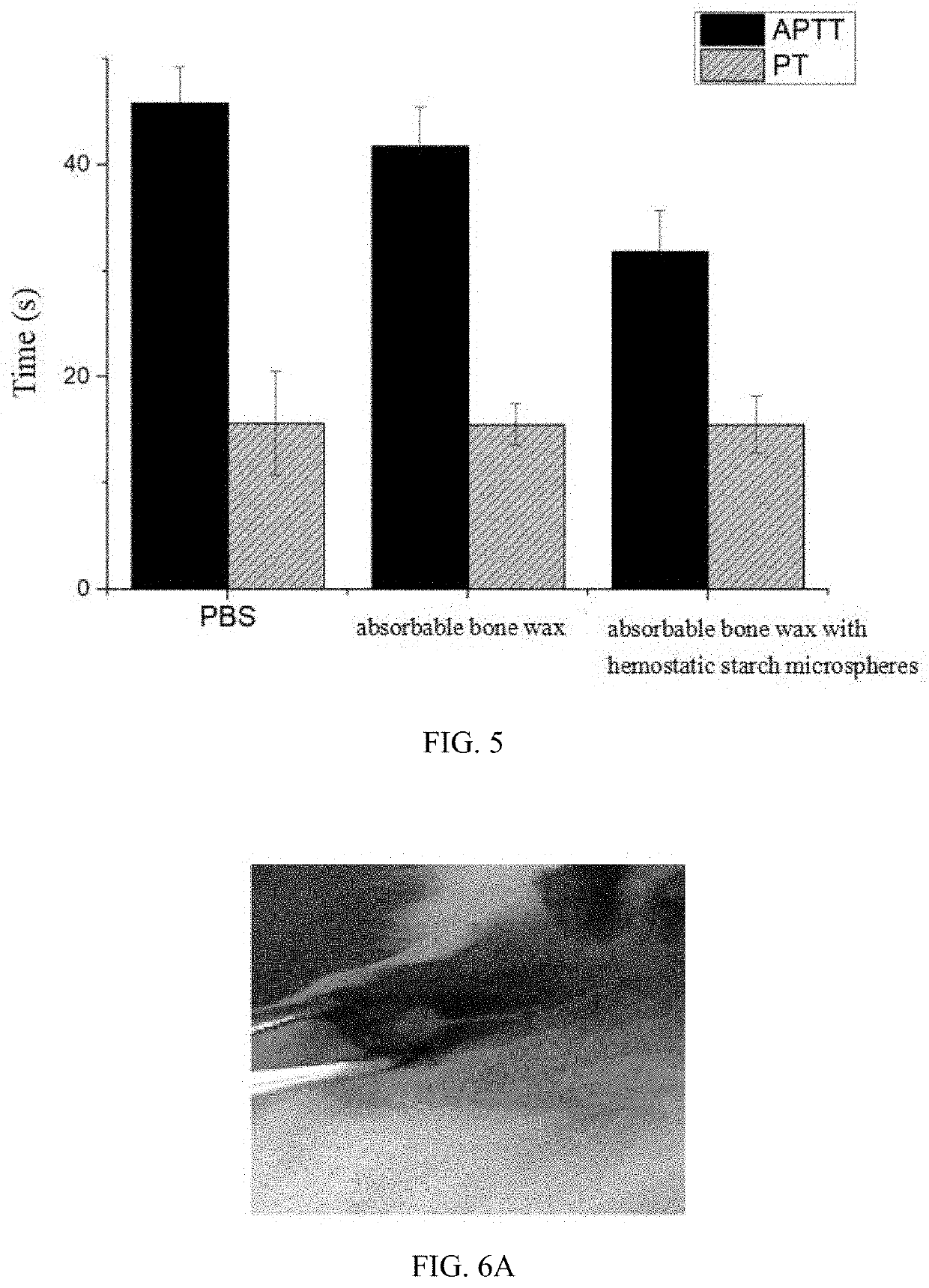 Absorbable bone wax and preparation method thereof