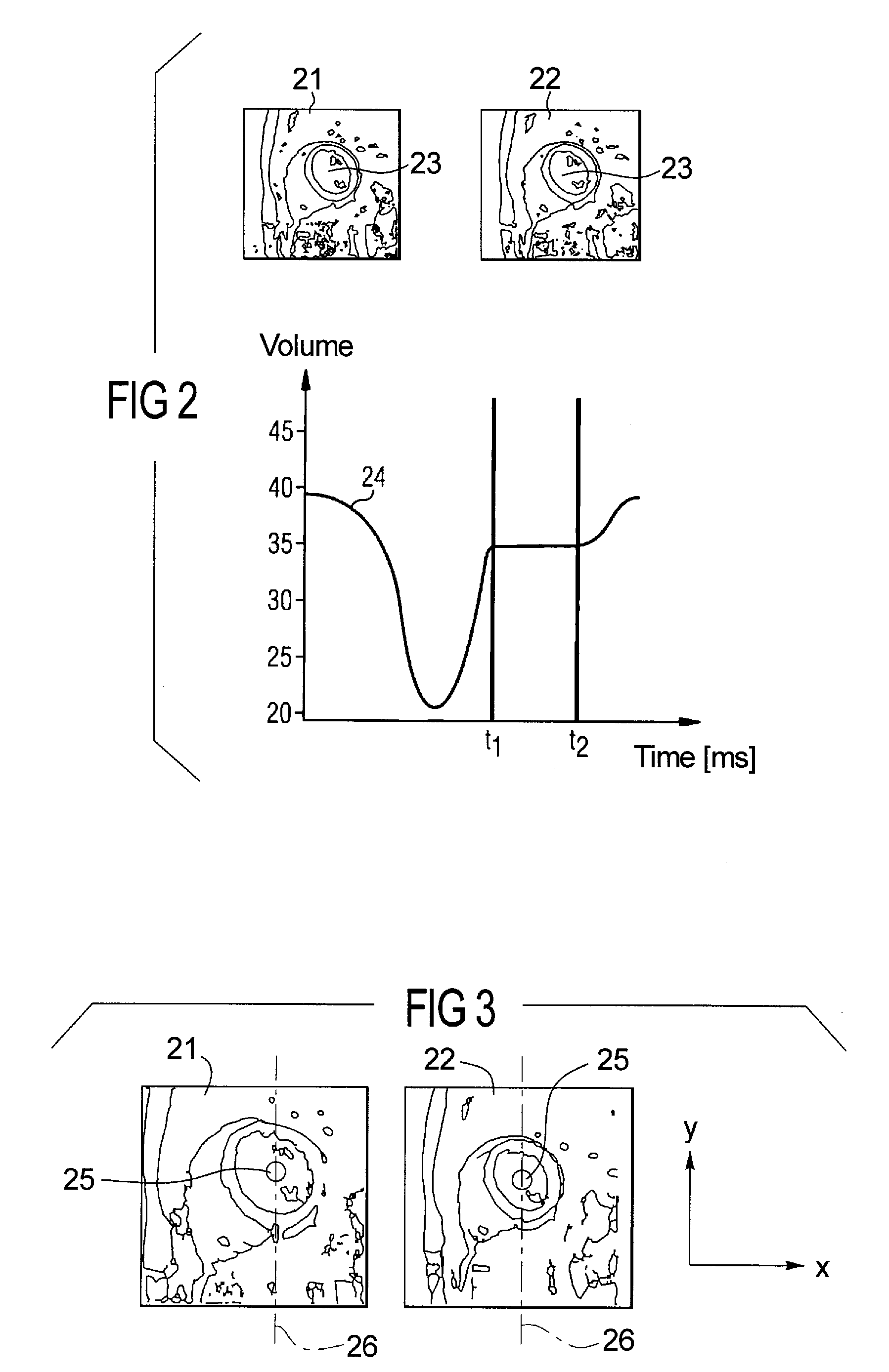Method and device to automatically determine the rest phase of the heart
