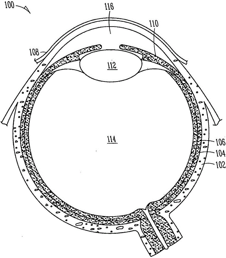 Lacrimal implants