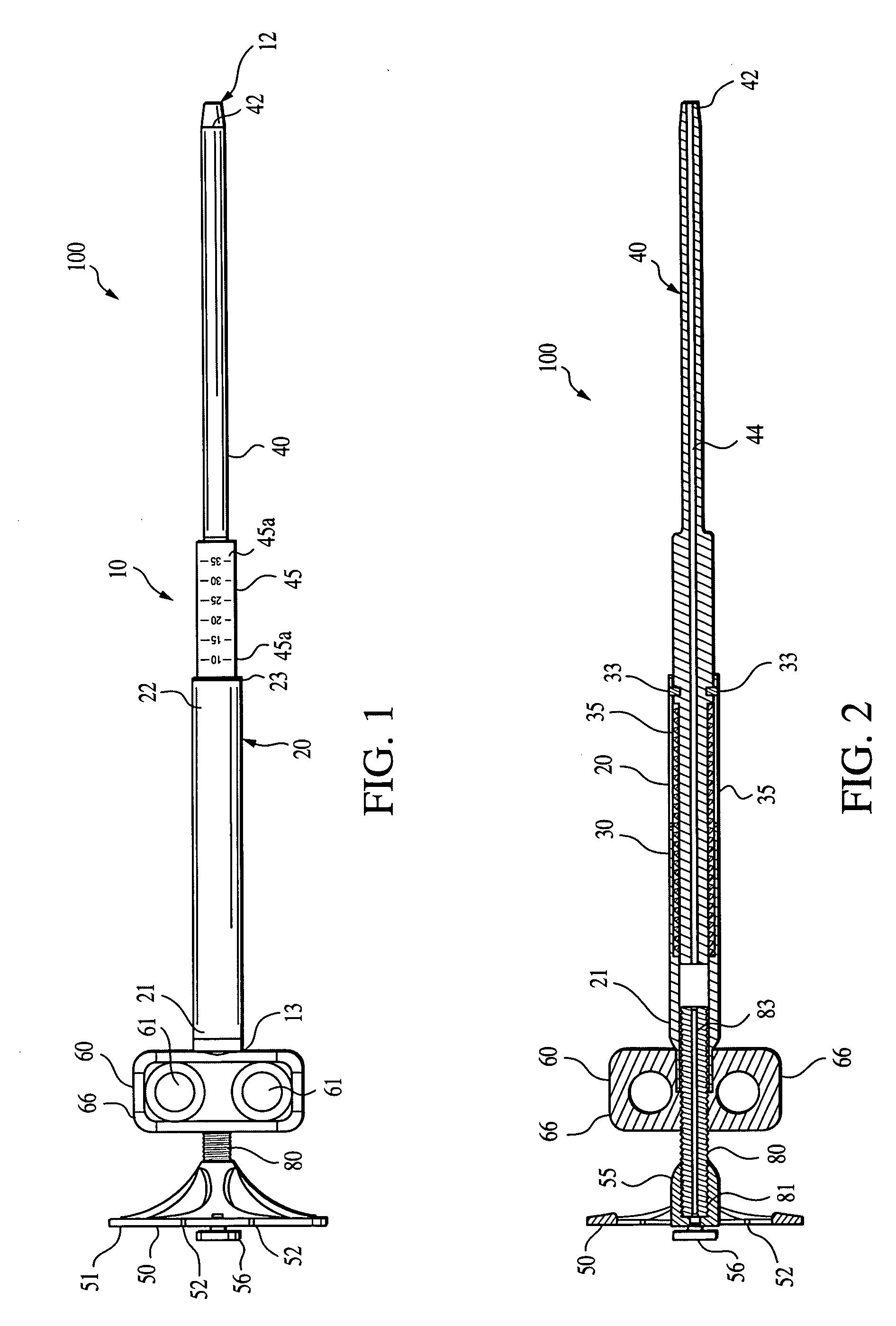 Suture tensioning device