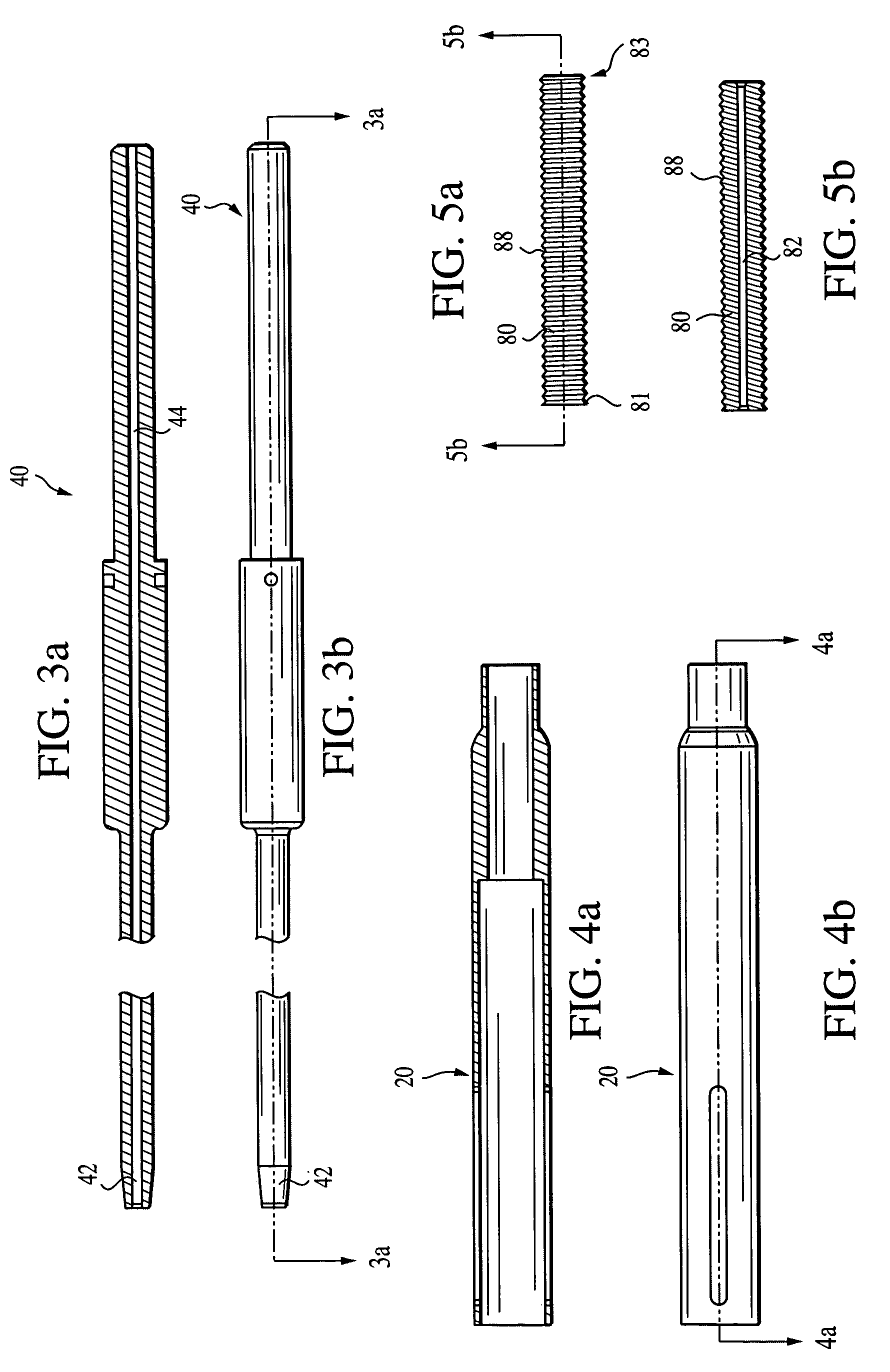 Suture tensioning device