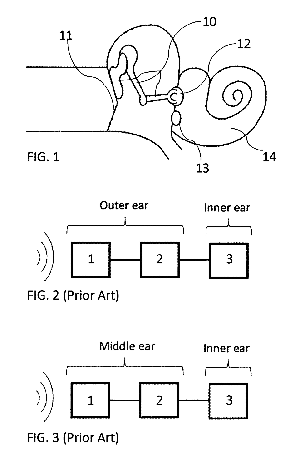 Energy harvesting cochlear implant