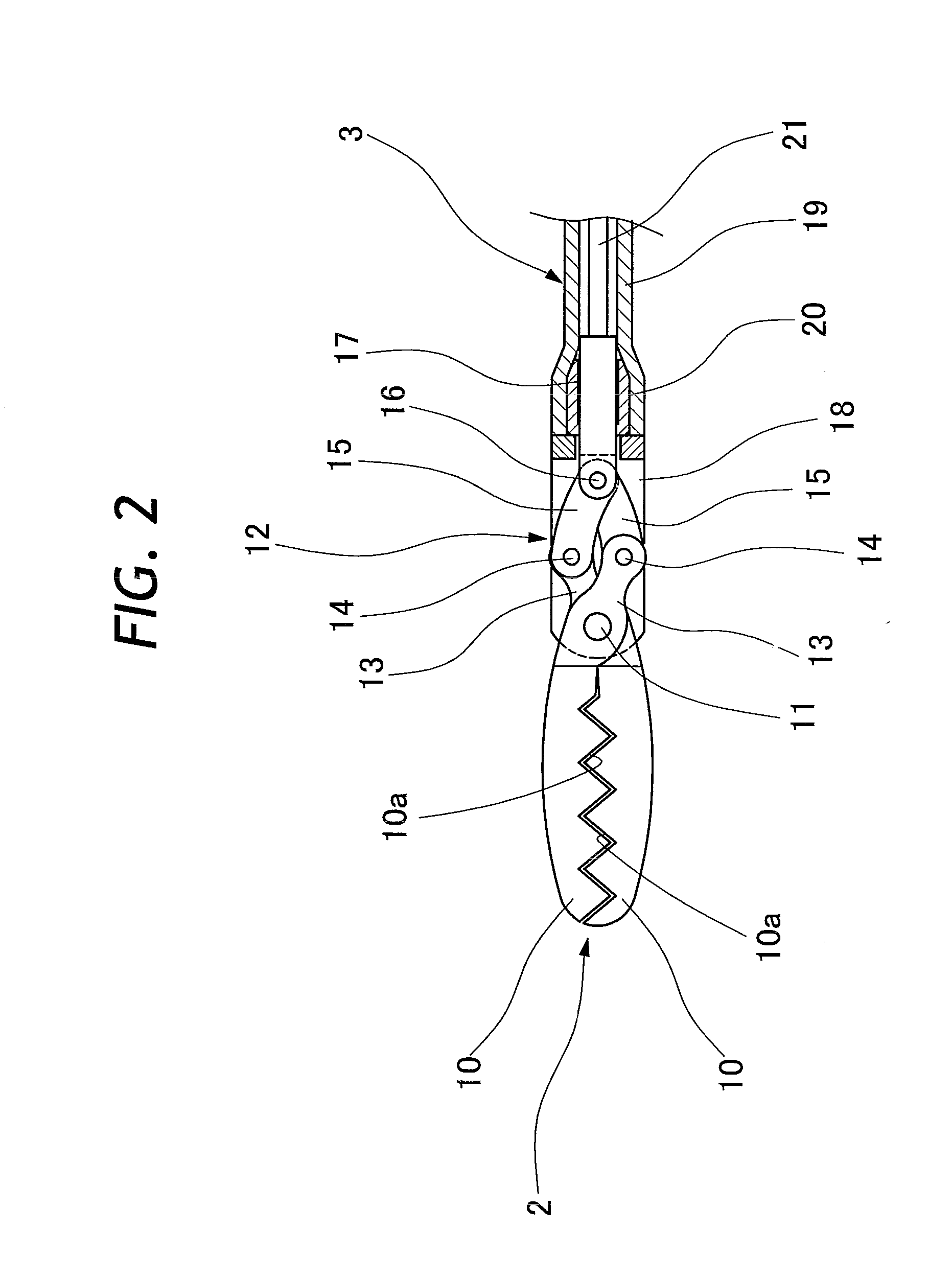 Endoscopically inserting surgical tool