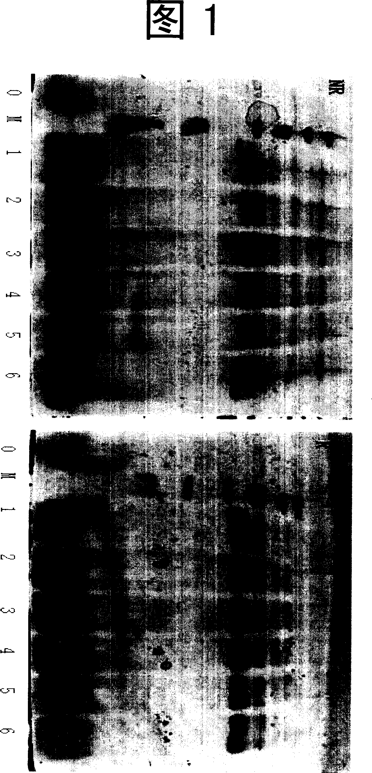 Using methanol yeast to produce human kallikrein - 1