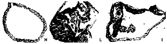 For the evaluation of intestinal lipid accumulation and its intervention reagents or kits and applications and detection