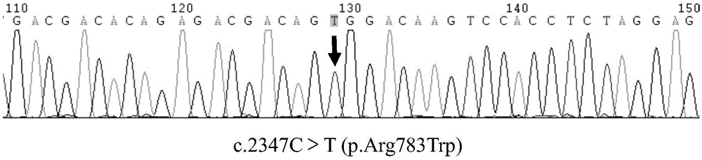 Multiplex-PCR detection method for single sperm