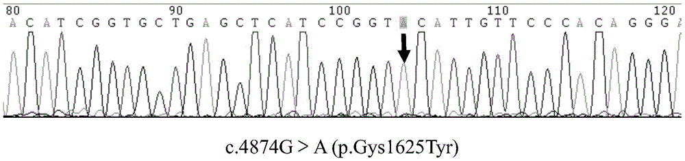 Multiplex-PCR detection method for single sperm