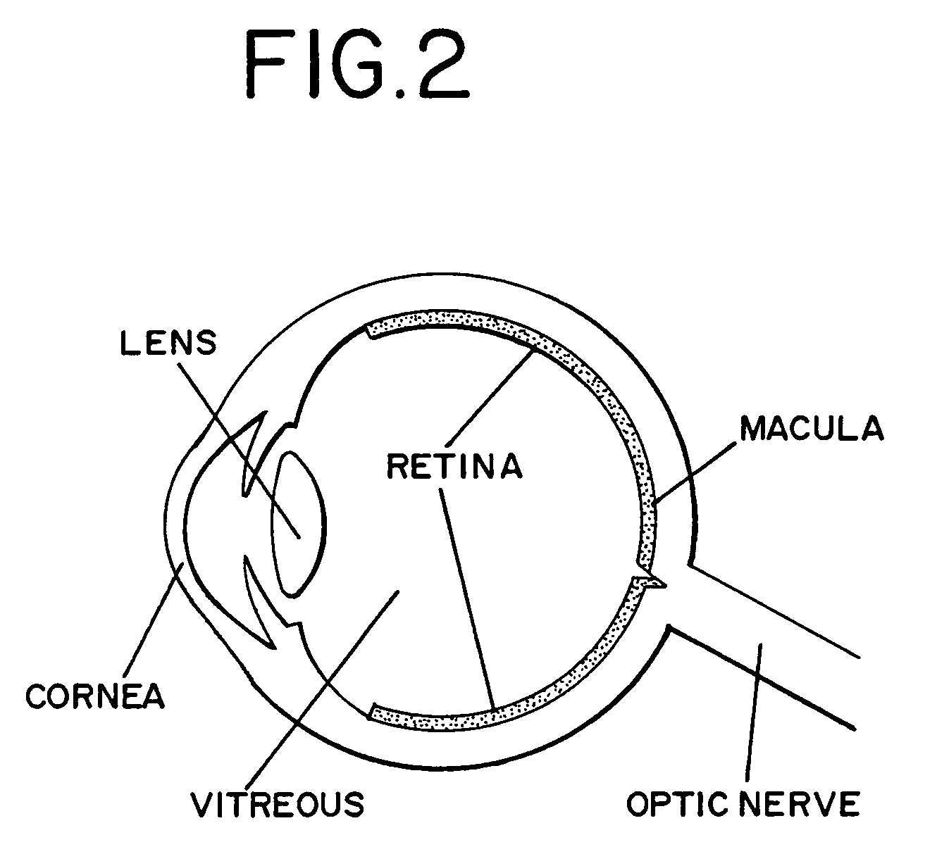 Ophthalmic treatment apparatus