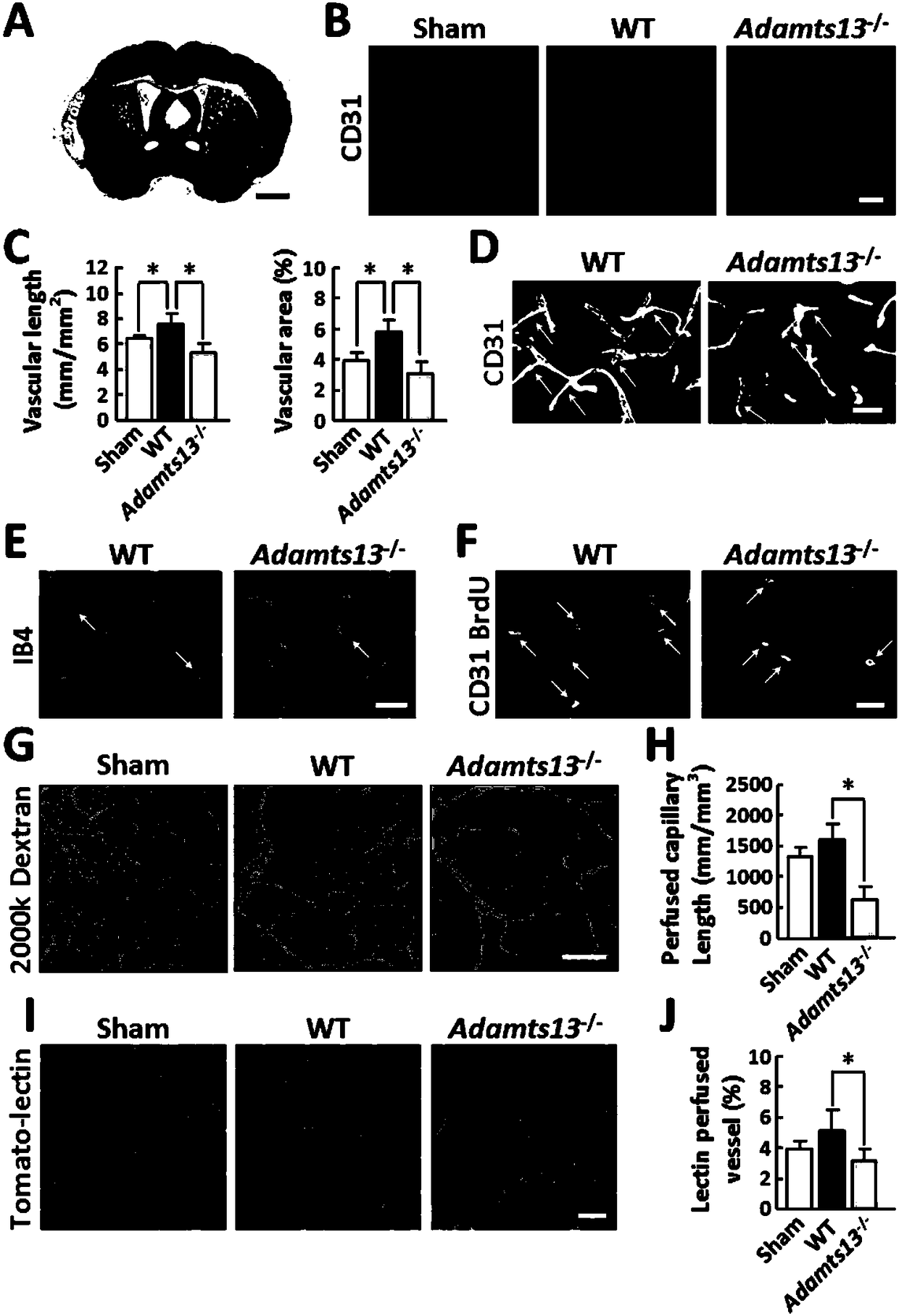 Application of ADAMTS13 to preparation of drugs used for promoting vascular remodeling after stroke