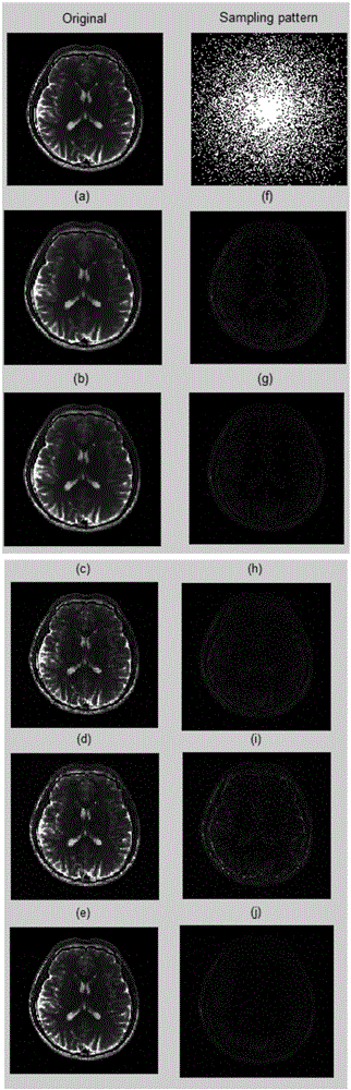 Generalized tree sparse-based weight nuclear norm magnetic resonance imaging reconstruction method