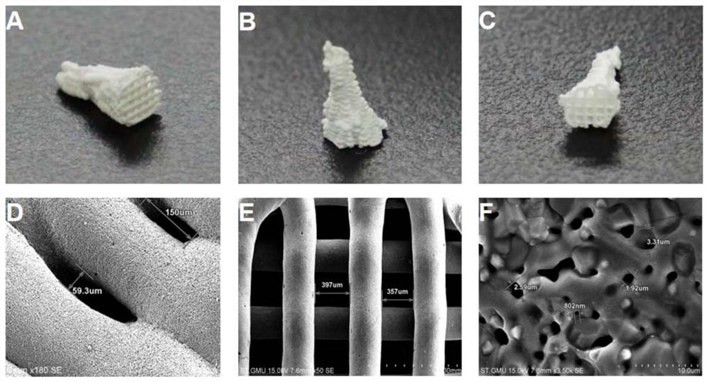 3D printed tooth root stent for alveolar bone site preservation, and preparation method thereof
