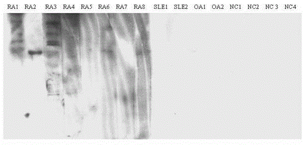 Application of fibroblast-like synoviocytes in preparation of rheumatoid arthritis (RA) diagnosis reagent