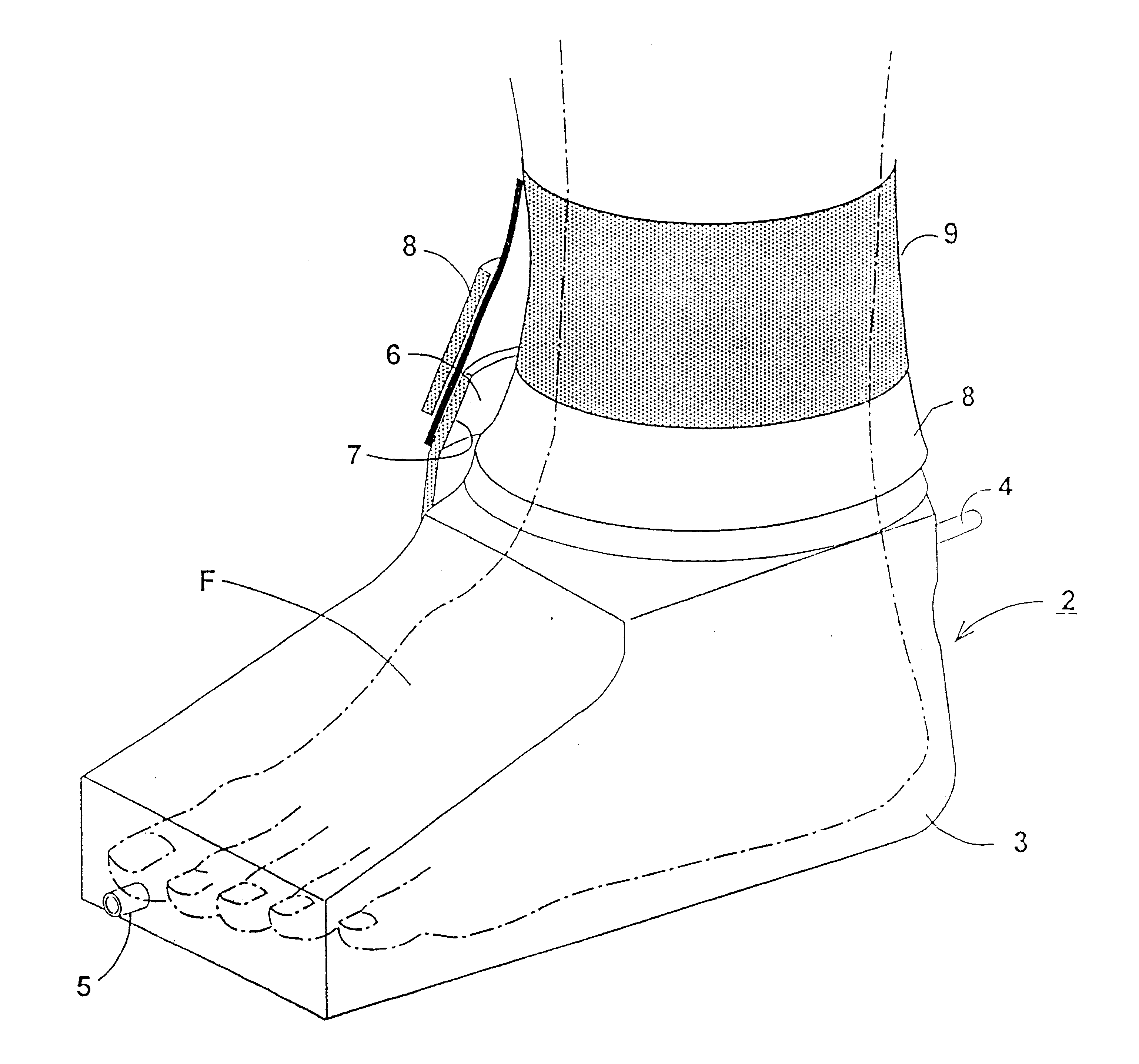 Apparatus and method of treatment of wounds, burns and immune system disorders