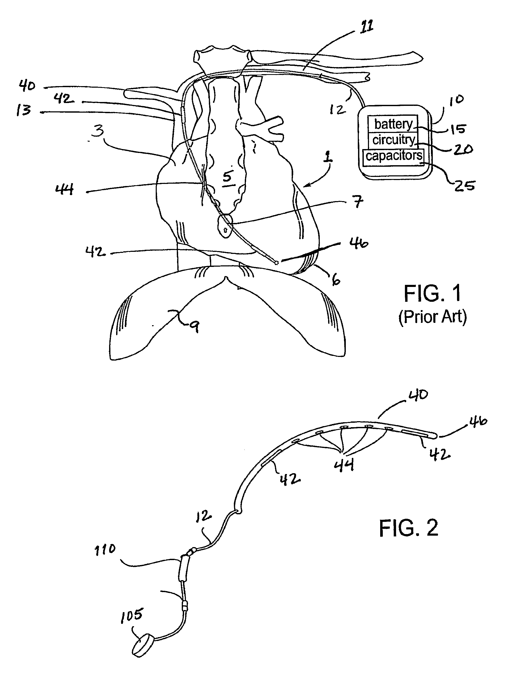 Implanted cardiac device for defibrillation