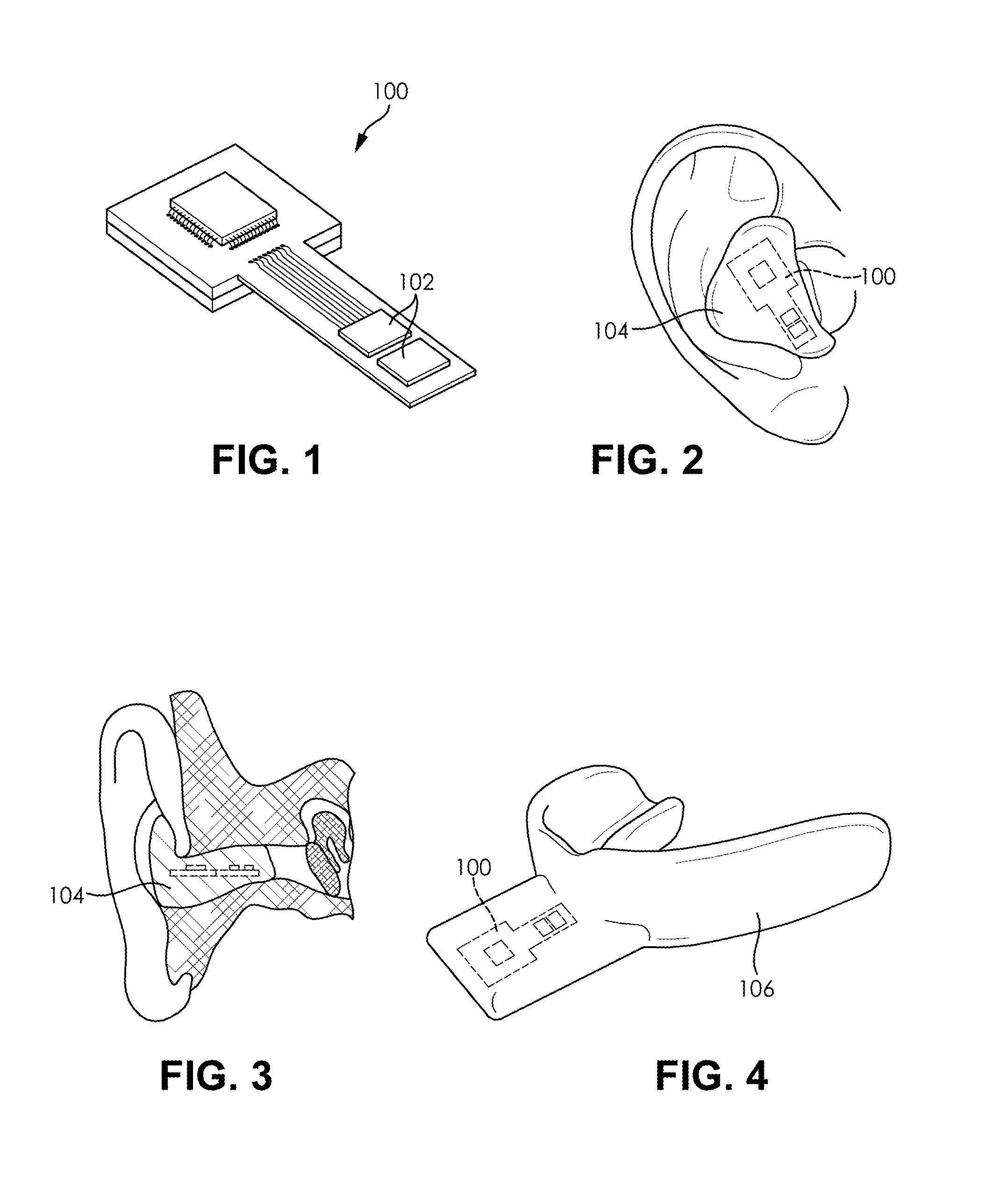 System and method for head acceleration measurement in helmeted activities