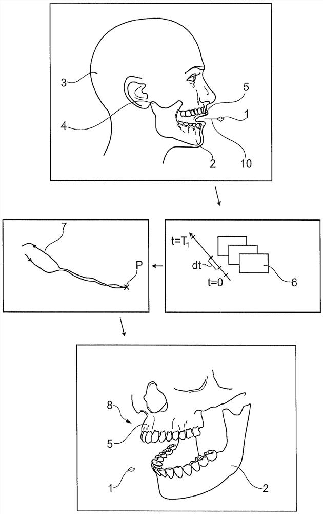 Method for detecting movement of temporomandibular joint
