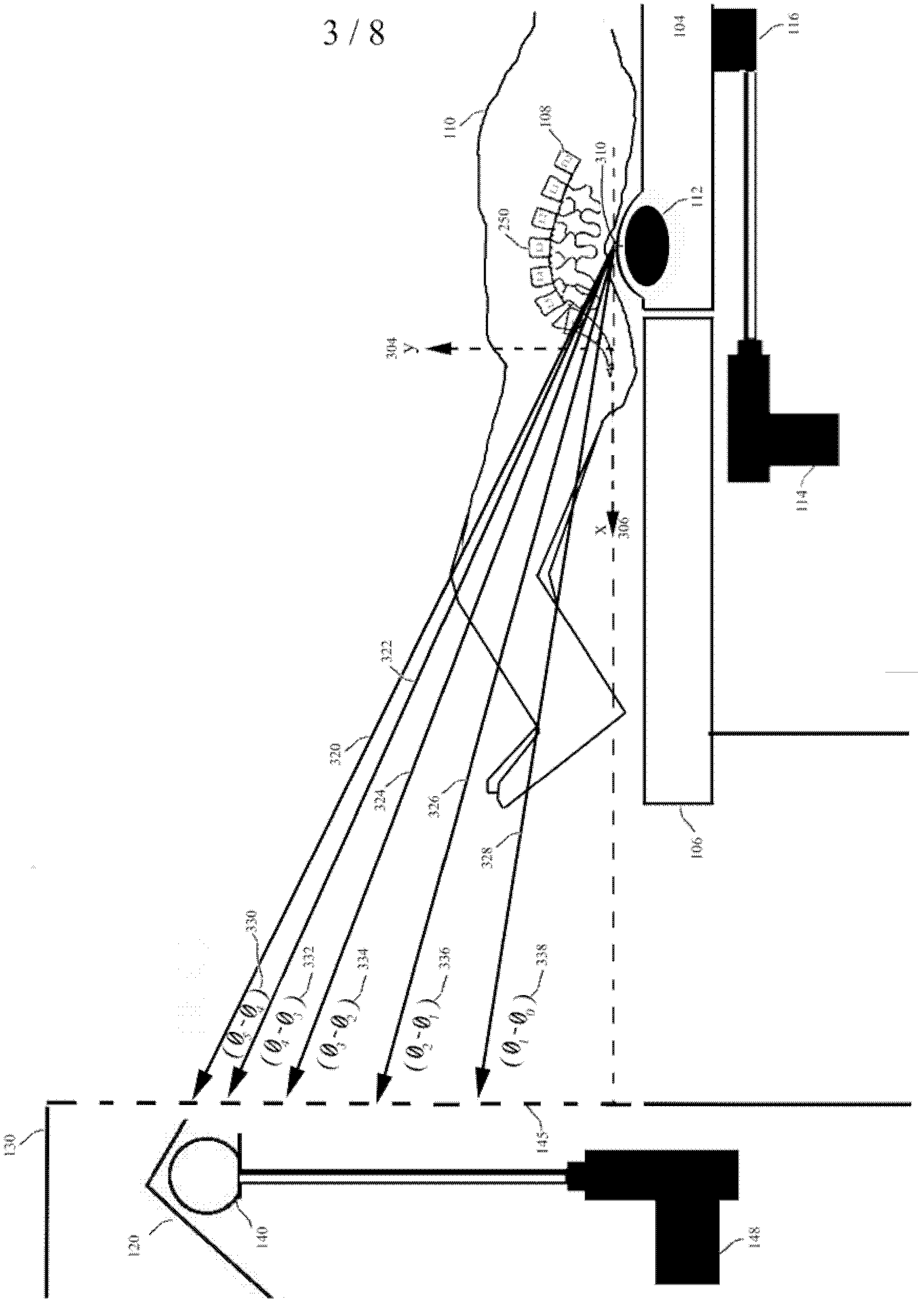 System capable of enabling difference realignment to be carried out on spinal column under tensile force