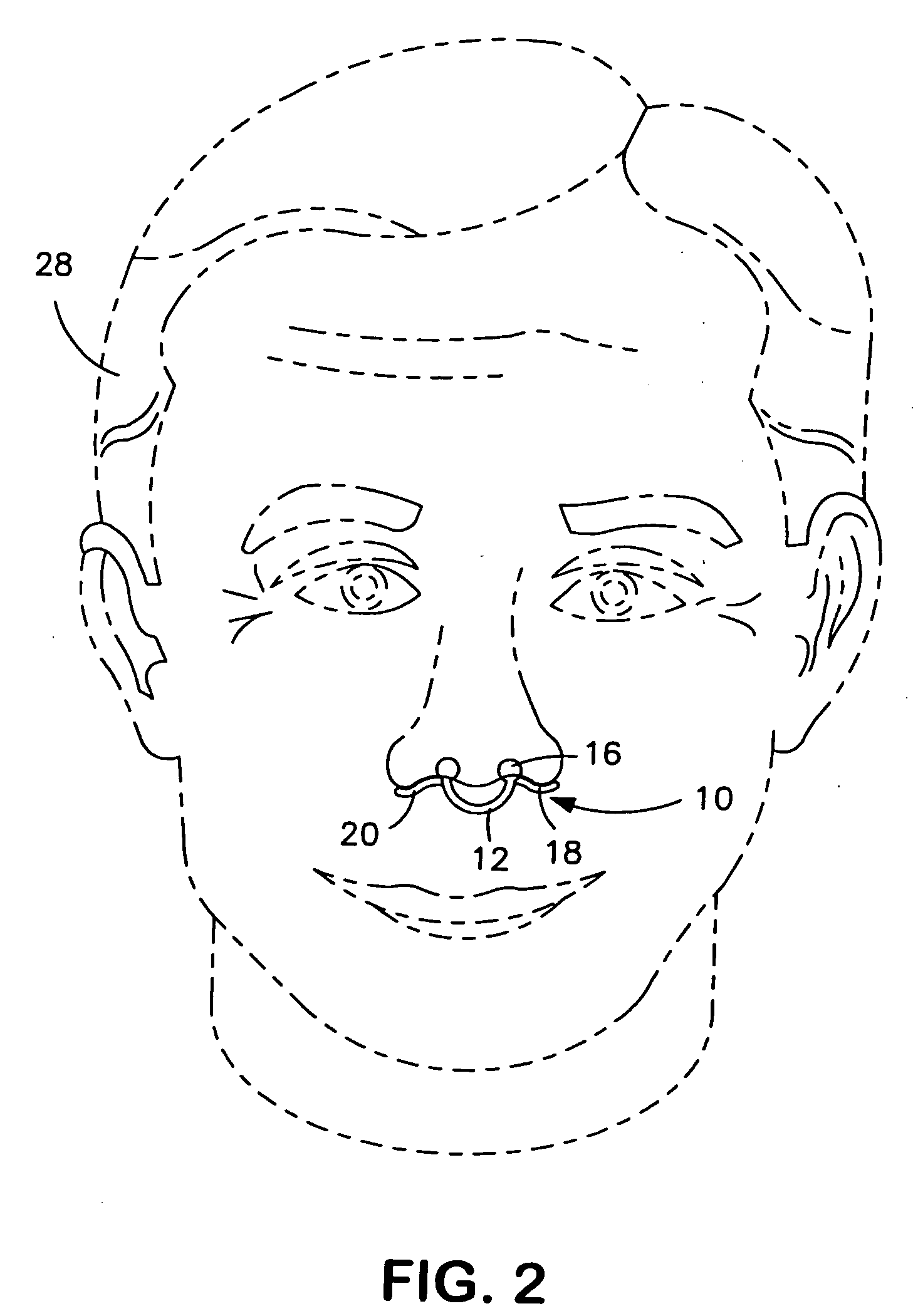 Disposable nasal filter